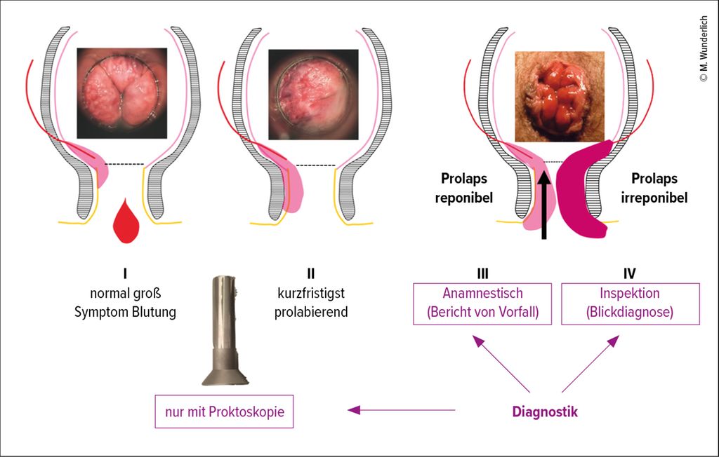 Frauenheilkunde Und Proktologie Gyn kologie Geburtshilfe frauenheilkunde-und-proktologie-gyn-kologie-geburtshilfe